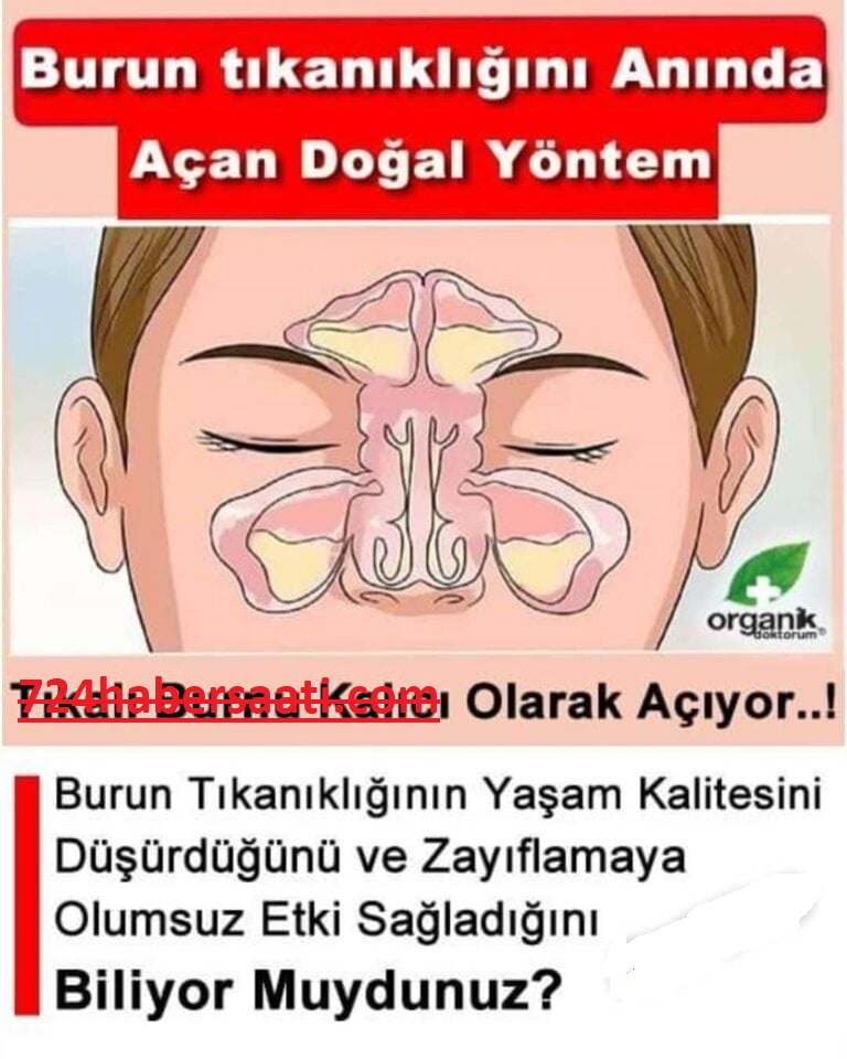 Burun Tıkanıklığına Çözüm